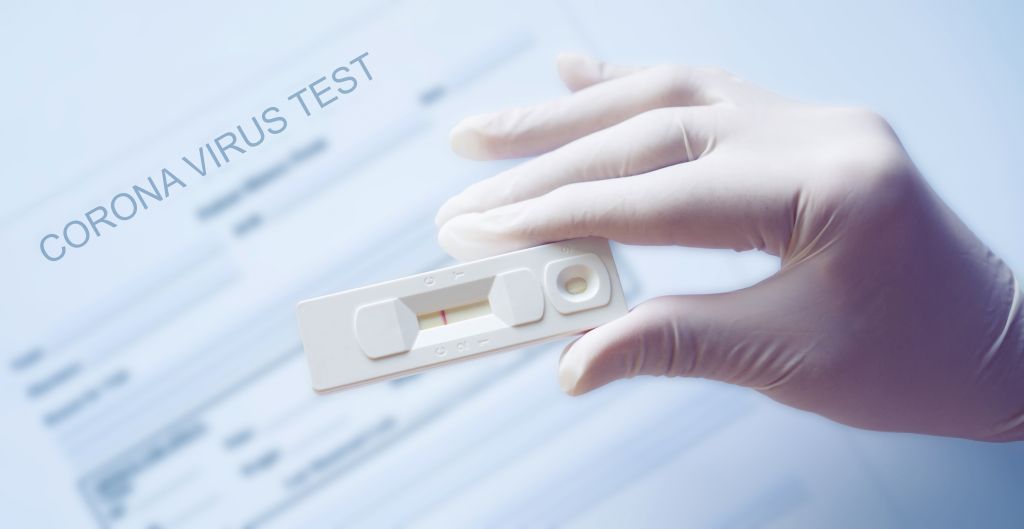 Negativní testy na koronavirus pro dovolenou v Řecku nebudou pro české občany potřeba